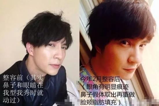 薛之谦整容对比照被曝光?薛之谦什么时候自曝做过微整?