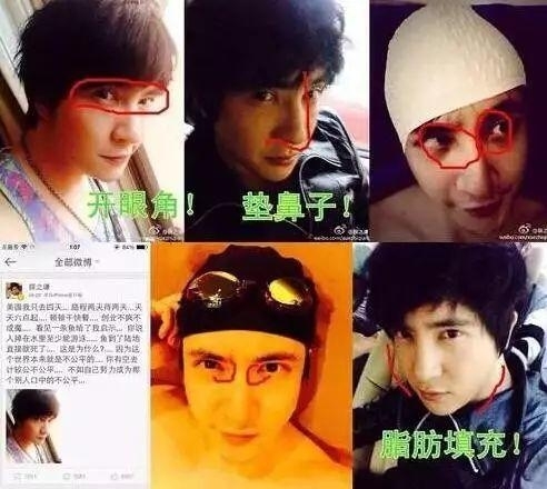 薛之谦整容对比照被曝光?薛之谦什么时候自曝做过微整?
