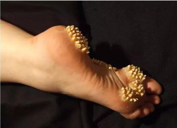 你有没有密集恐惧症?看完这组图就知道了