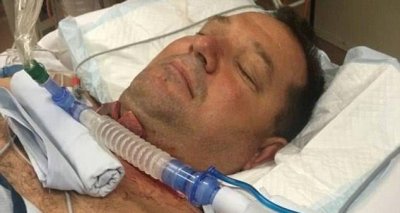 ​男子吃烧烤被牛排差点被牛排噎死，妻子立马拿刀割开丈夫喉咙