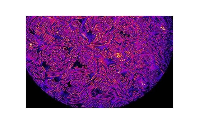患尖锐湿疣注意性生活节制吗 护理尖锐湿疣患者有哪些注意事项 患尖锐湿疣注意性生活节制吗 护理尖锐湿疣患者有哪些注意事项