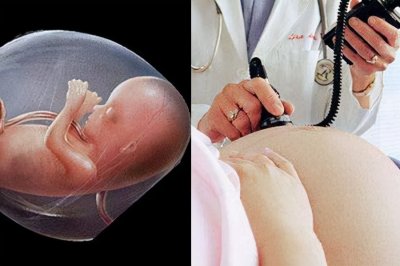 ​什么是胎芽、胎心？胎心又有什么意义？